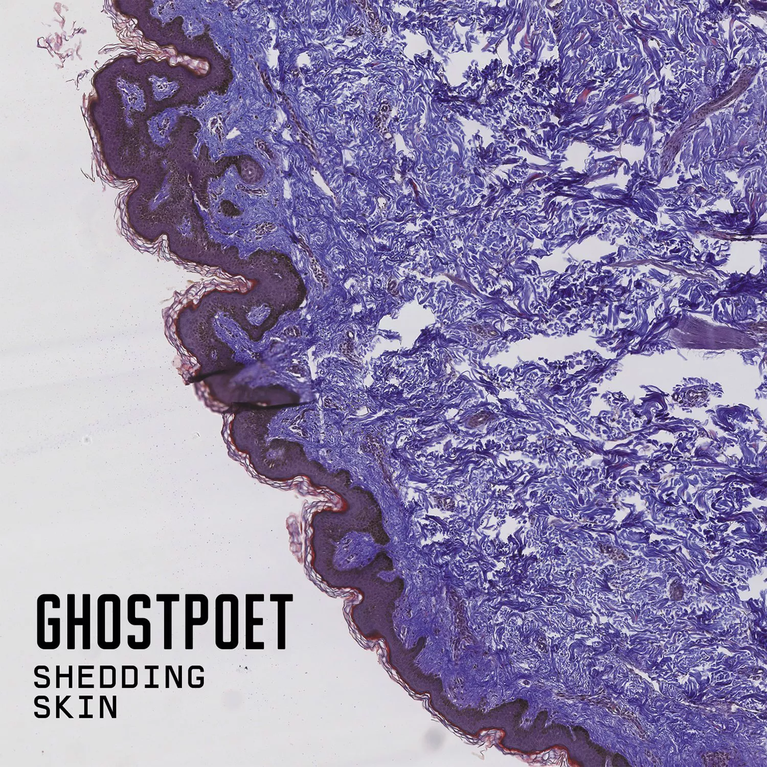 Shedding Skin - Ghostpoet